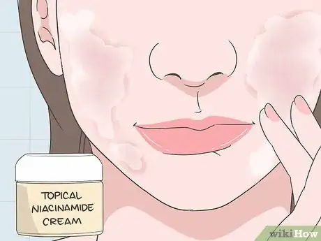 Image titled How to Treat Rosacea Can Herbal Remedies Help Step 3