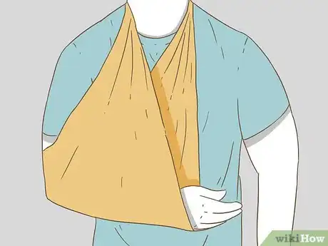 Image titled Apply Splints Step 4