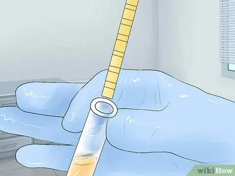 Image titled Diagnose an Overactive Bladder Step 6