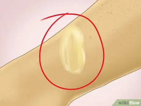 Image titled Heal a Cut Due to Dry Skin Step 8