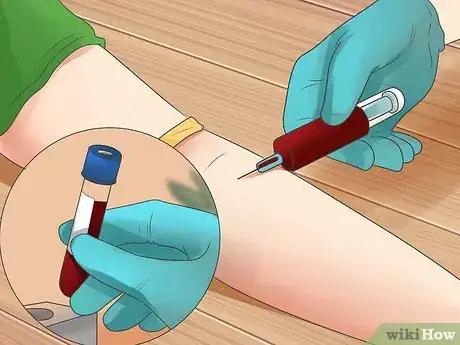 Image titled Test for Kidney Disease Step 2