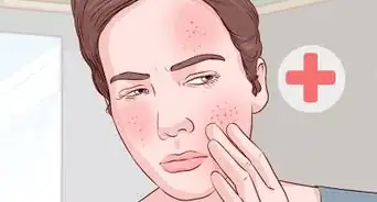 Treat Skin Conditions with Tea Tree Oil