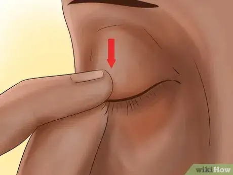 Image titled Administer Eye Drops in Children Step 23