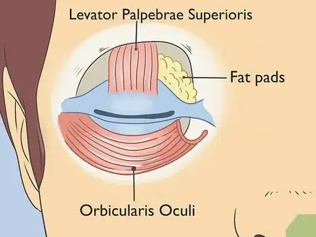 Image titled Treat Droopy Eyelids Step 6