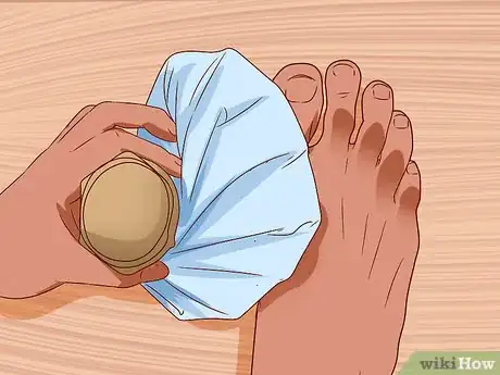 Image titled Apply Cold Therapy Step 13
