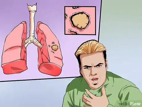 Image titled Prevent Aspergillosis Step 14