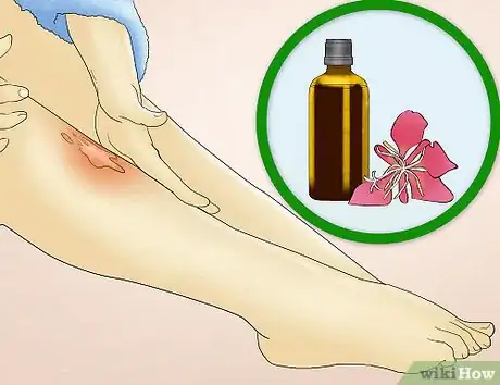Image titled Reduce Redness After Waxing Step 10