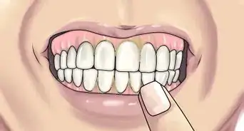 Prevent Fuzzy Teeth