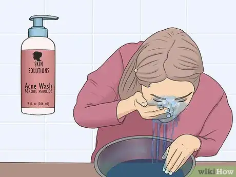 Image titled Use Tretinoin Cream Step 3