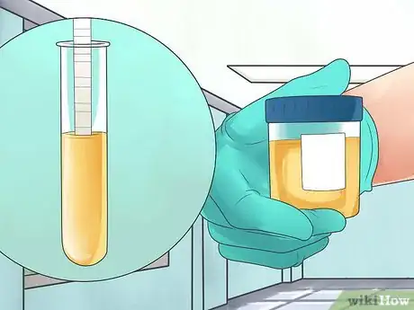 Image titled Test for Kidney Disease Step 3