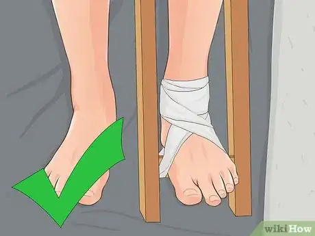 Image titled Make a Traction Splint for a Fractured Femur Step 10