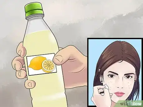 Image titled Get Rid of Cystic Acne Scars Step 2