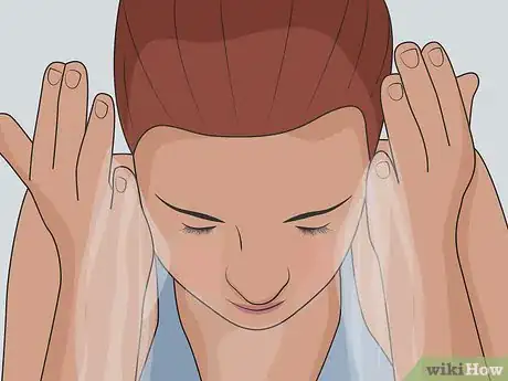 Image titled Clear Up Rosacea Without Medication Step 3