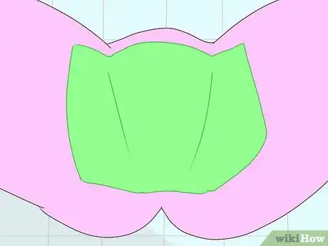 Image titled Prevent HPV Infection (Human Papillomavirus Infection) Step 4