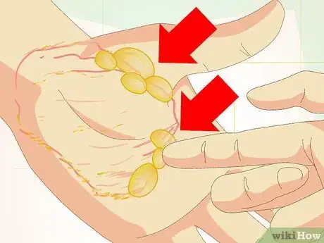 Image titled Care for Superficial Wounds Step 10