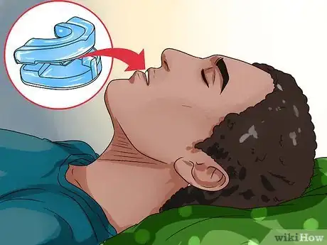 Image titled Stop Snoring by Using an Anti Snoring Mouthpiece Step 21