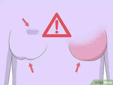 Image titled Diagnose Breast Cancer Step 3