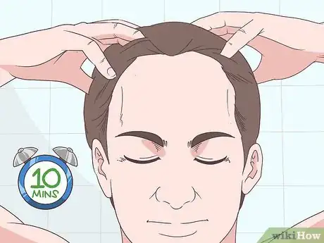 Image titled Make Your Hairline Grow Back Step 4