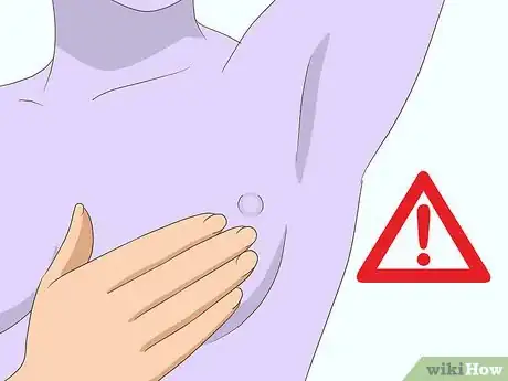 Image titled Diagnose Breast Cancer Step 1