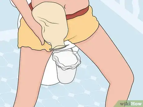 Image titled Get Used to an Ostomy Step 14