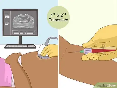 Image titled Detect Chromosomal Abnormalities Step 1