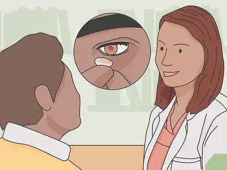 Image titled Deal With Uncomfortable Contact Lenses Step 15