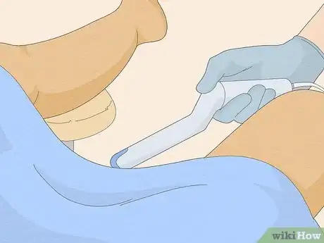 Image titled Get Ovarian Reserve Testing Done Step 10