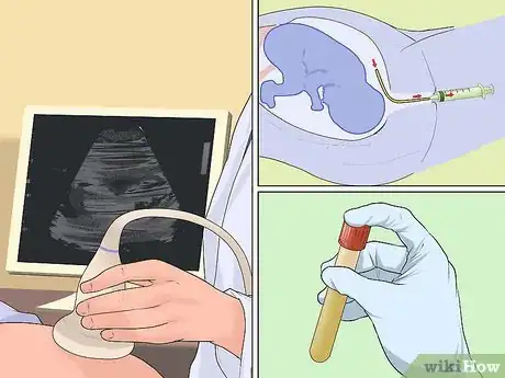 Image titled Test for Down Syndrome Step 7