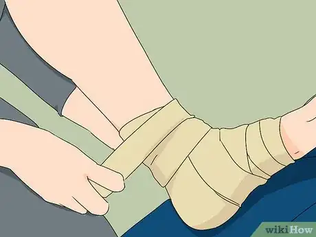 Image titled Prevent Ankle Sprains Step 16