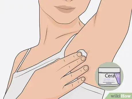 Image titled Heal Armpit Rash Step 5