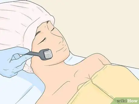 Image titled Treat Under Eye Wrinkles Step 20