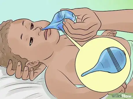 Image titled Stop a Breast Feeding Baby From Biting Step 4