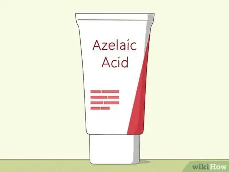 Image titled What Products Can Clear Your Skin Step 5