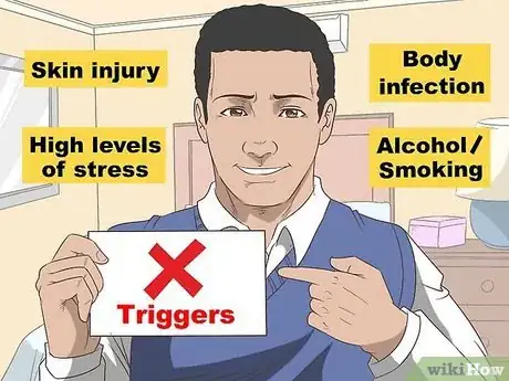 Image titled Care for Psoriasis Step 1