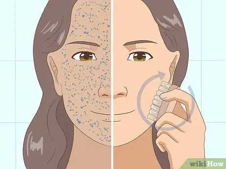 Image titled Get Fair Skin Naturally Step 1