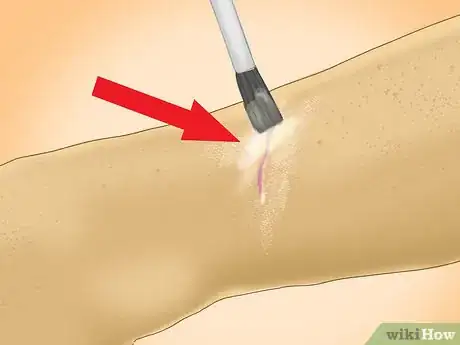 Image titled Heal a Cut Due to Dry Skin Step 7