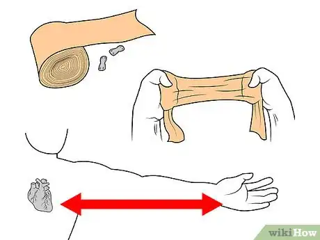 Image titled Wrap a Wrist Step 1