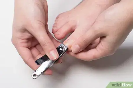 Image titled Soak an Ingrown Toenail Step 7