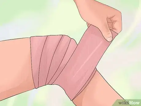 Image titled Protect Yourself from an ACL Tear Step 7