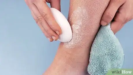 Image titled Treat Razor Bumps on Legs Step 2