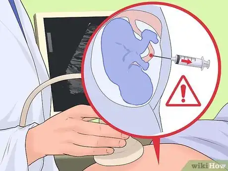 Image titled Test for Down Syndrome Step 8