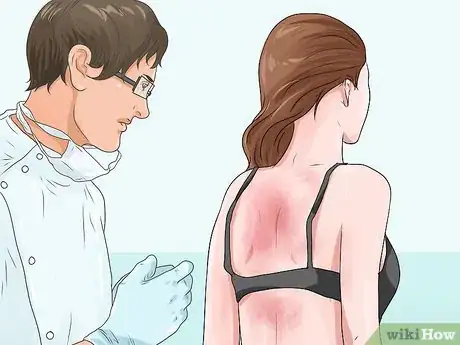 Image titled Treat Erythrodermic Psoriasis Step 12