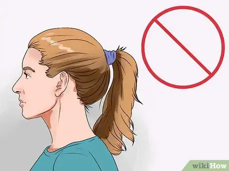 Image titled Choose the Right Hair Loss Option Step 8