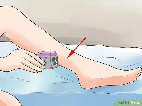 Image titled Epilate Legs Step 8