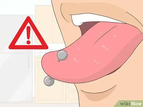 Image titled Prevent Gum Disease Step 15