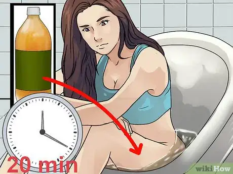 Image titled Treat Vaginal Cysts Step 7