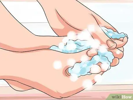 Image titled Remove a Dead Toenail Step 2