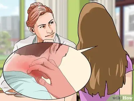 Image titled Reduce Eczema Itching Step 20