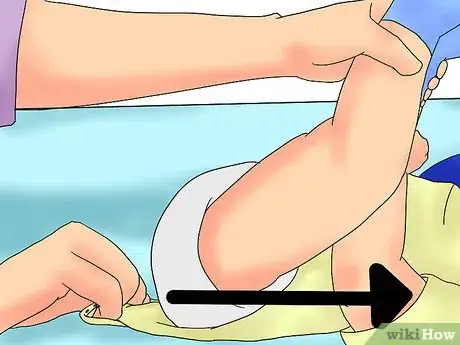 Image titled Change a Onesie on an Infant or Young Toddler Step 4