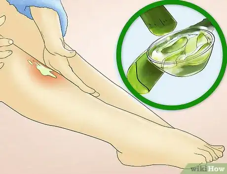 Image titled Reduce Redness After Waxing Step 14